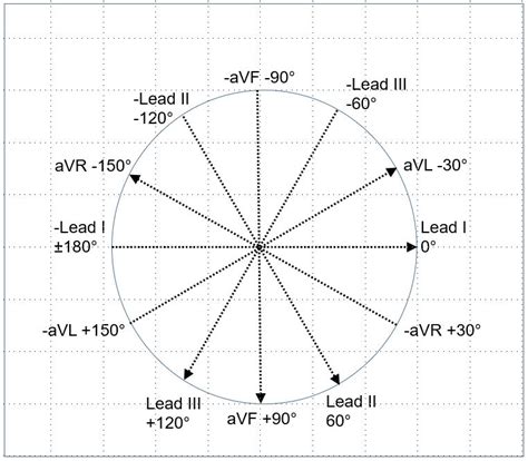 determining mean electrical axis couting boxes|mean electrical axis formula.